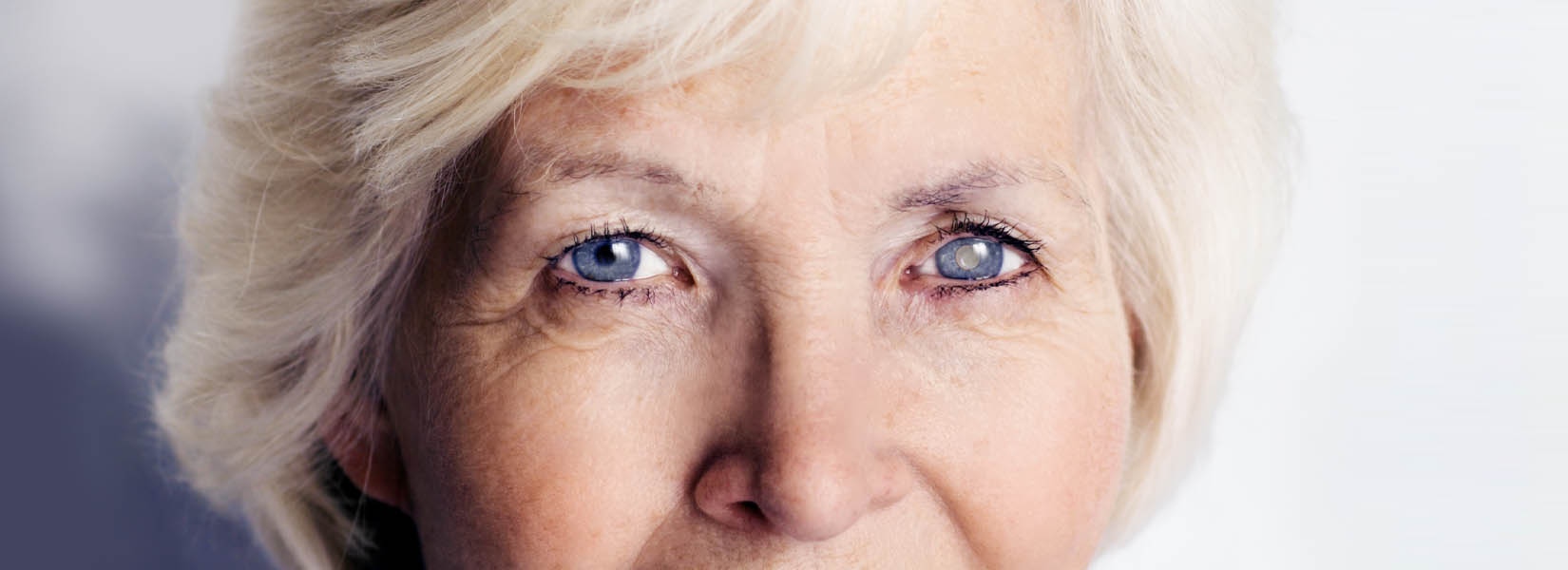 Cataract Surgery in Raytown
